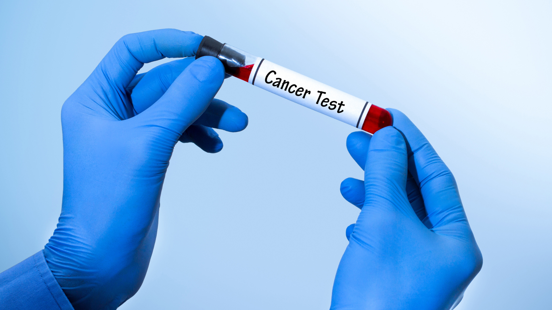 Cancer Testng (PSA)